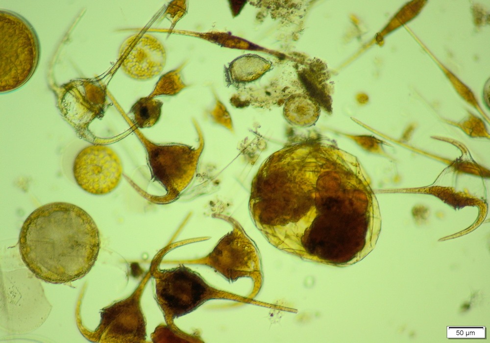 Imgi 25 Synchaeta 1000 700 1